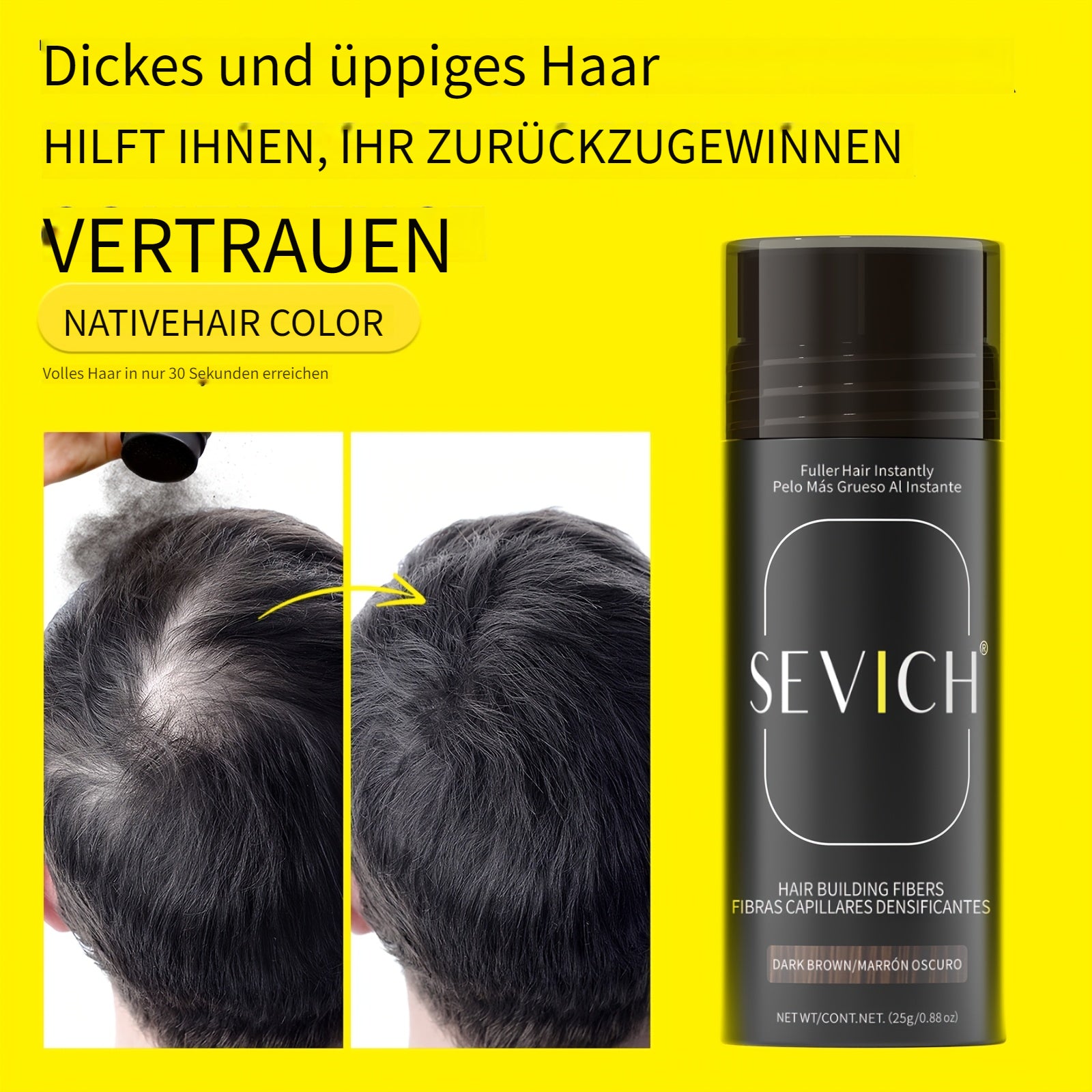 Sevich Haarverdichtungsfasern, 25g für Männer und Frauen – Hauptansicht